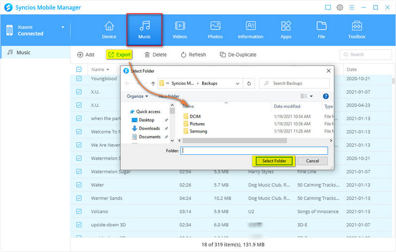 export Xiaomi 15 music to computer